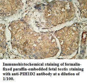 PIH1D2 Antibody (aa25-313)
