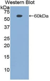 Polyclonal Rabbit anti-Human PCNA Antibody (aa6-261, WB)
