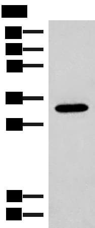 Polyclonal Rabbit anti-Human RGR Antibody (IHC, WB)