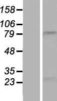 NBPF15 Protein (Over-Expression Lysate Myc-DDK (Flag))