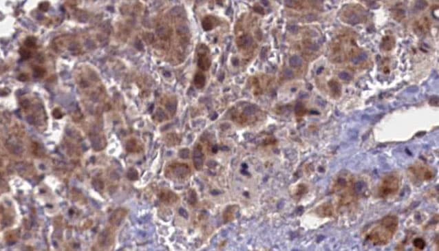 CHRNA5 Antibody