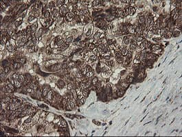 FAM164A / CGI-62 Antibody (clone OTI4C1)