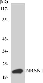 AKIP1 / BCA3 Antibody (aa85-134)