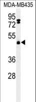 Polyclonal Rabbit anti-Human FBXL2 Antibody (aa366-395, IHC, WB)