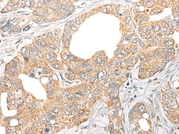 CCL5 / RANTES Antibody
