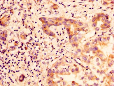 Polyclonal Rabbit anti-Human GLIPR1 / GLIPR Antibody (WB)