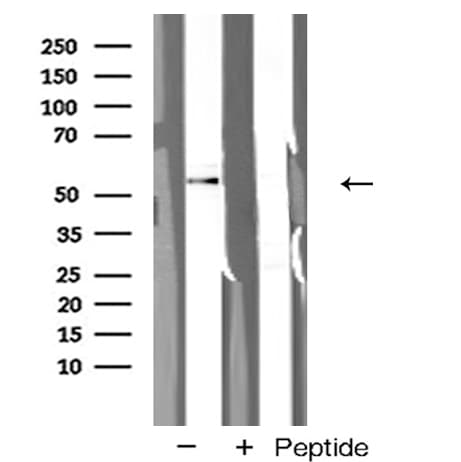 ABI1 / SSH3BP1 Antibody