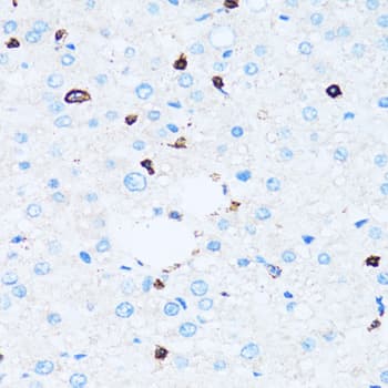 SPN / CD43 Antibody