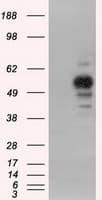 PRKAR2A Antibody (clone OTI5F1)
