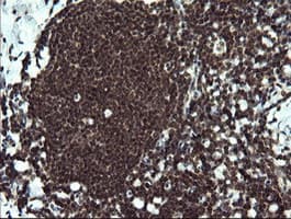 ETS2 Antibody (clone OTI1H4)