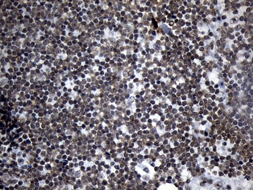 Monoclonal Mouse anti-Human ZNF705D Antibody (clone OTI1G1, IHC, WB)
