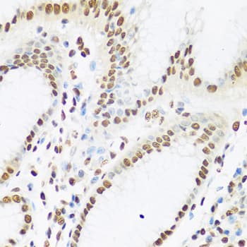 XRCC5 / Ku80 Antibody