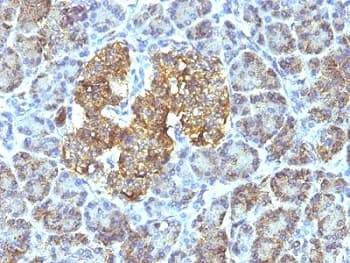 HSPD1 / HSP60 Antibody (clone SPM253)