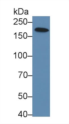 XRN1 Antibody