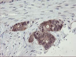 Monoclonal Mouse anti-Human TSC22D1 / TSC22 Antibody (clone OTI4F1, IHC, WB)