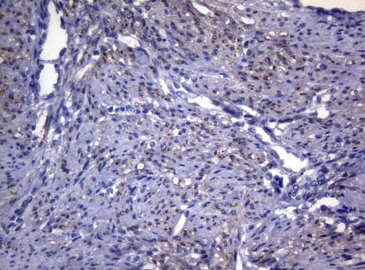 SYNC / SYNCOILIN Antibody (clone OTI5B8)