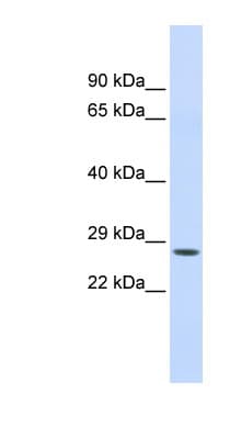 Chymotrypsin C Antibody (N-Terminus)