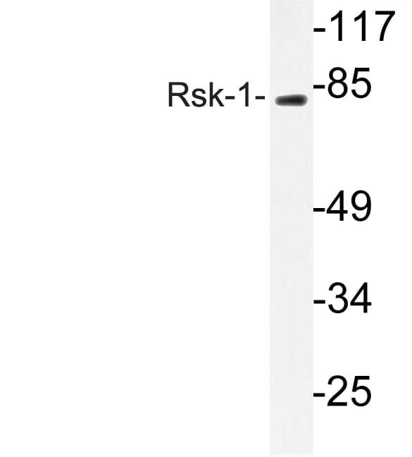 RPS6KA1 / RSK1 Antibody (Glu567)