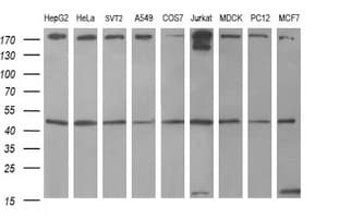 IHC-plus™ TUBB1 / Tubulin Beta 1 Antibody (clone 4A3)