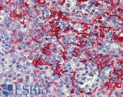 IHC-plus™ Polyclonal Rabbit anti-Human PKP2 / Plakophilin 2 Antibody (IHC, WB)