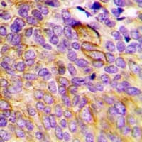 Polyclonal Rabbit anti-Human CCBL1 Antibody (IHC, IF, WB)