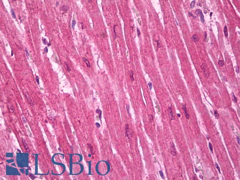 IHC-plus™ PPARG / PPAR Gamma Antibody (clone 8D1H8F4)