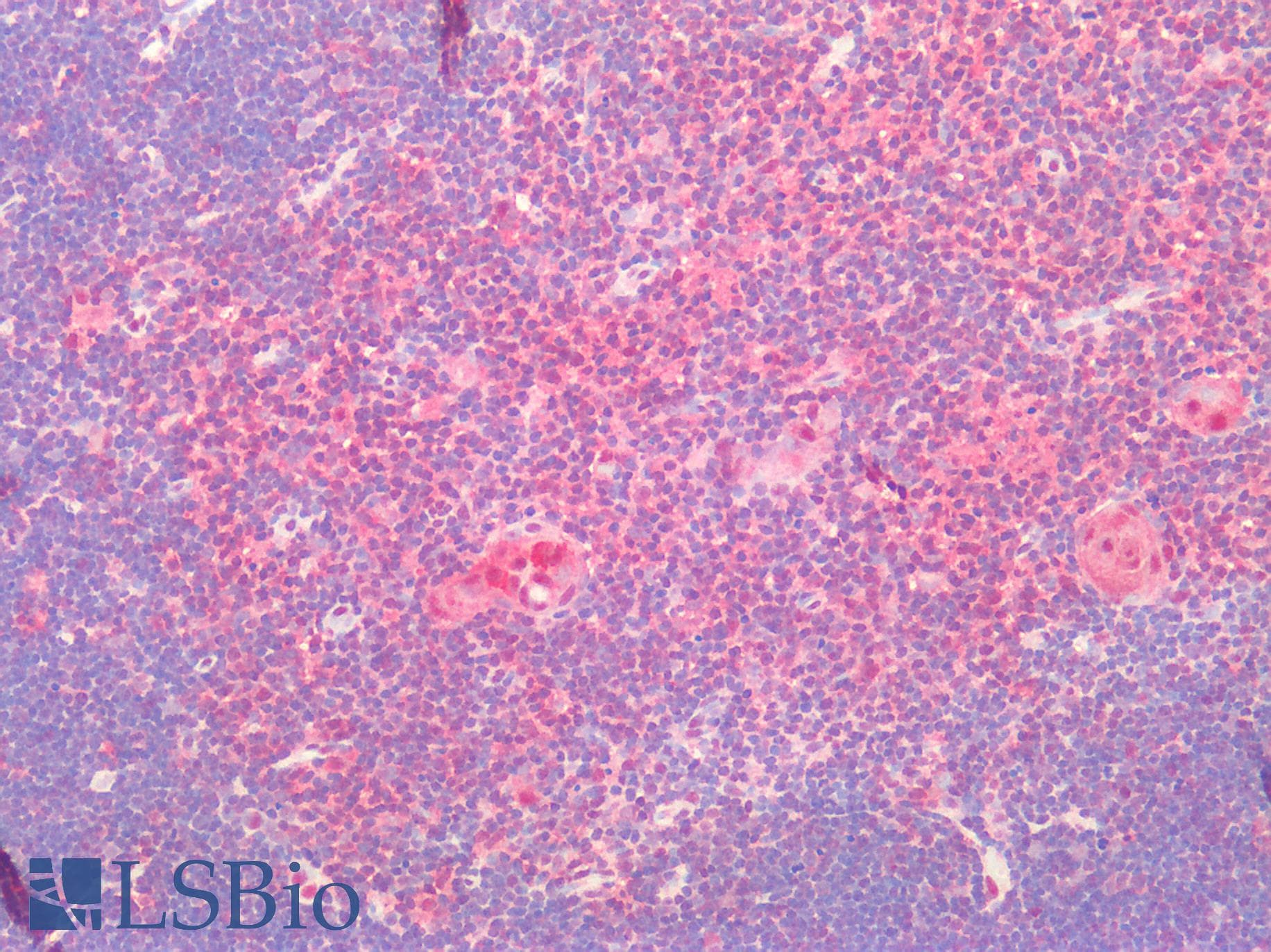 PathPlus™ FFAR2 / GPR43 Antibody (Extracellular Domain)
