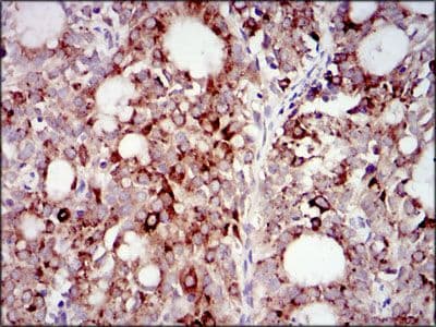 Monoclonal Mouse anti-Human PIK3R1 / p85 Alpha Antibody (clone 6G10, Amino Acid: 159-388, IHC, IF, WB)