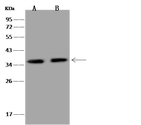 CEBPZ / CBF Antibody