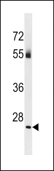 TBC1D26 Antibody (aa214-241)