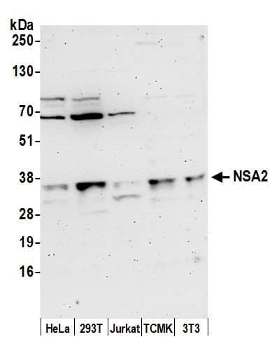 Hypothetical Protein / TINP1 Antibody (aa150-200)