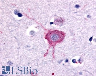 IHC-plus™ GRM2 / MGLUR2 Antibody (N-Terminus)