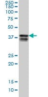 IHC-plus™ HNRNP-E2 / PCBP2 Antibody (clone 5F12)