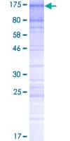 Human SUV420H1 Protein (Recombinant GST)