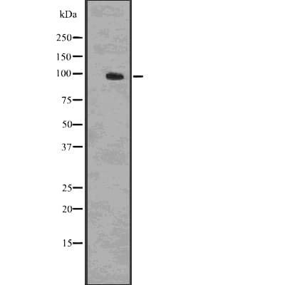 CTNNB1 / Beta Catenin Antibody (phospho-Ser37,pSer33,pThr41)