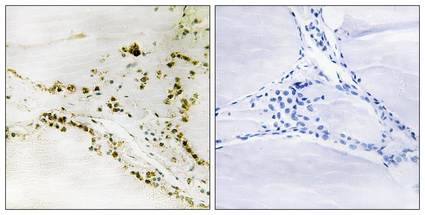 Polyclonal Rabbit anti-Human PIN1 Antibody (Ab-1619, IHC, IF)