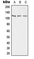 IHC-plus™ ATP2B2 / PMCA2 Antibody (Internal)
