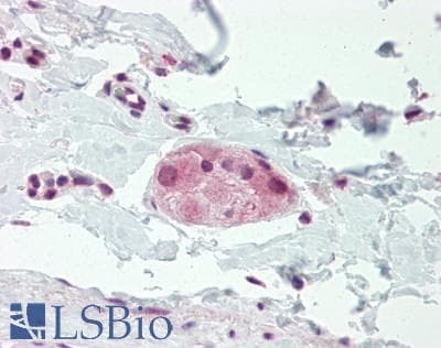 IHC-plus™ ARHU / RHOU Antibody