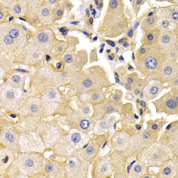 KLKB1 / Plasma Kallikrein Antibody