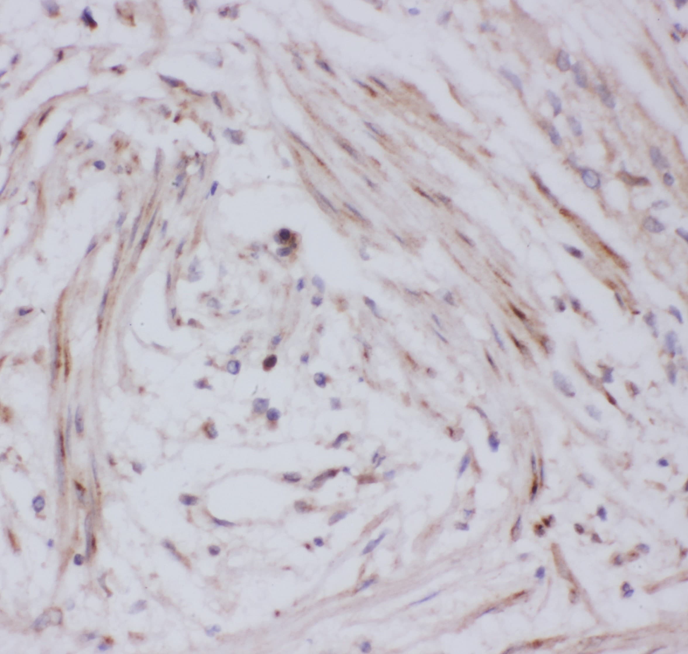 SLC2A4 / GLUT-4 Antibody (aa333-509)
