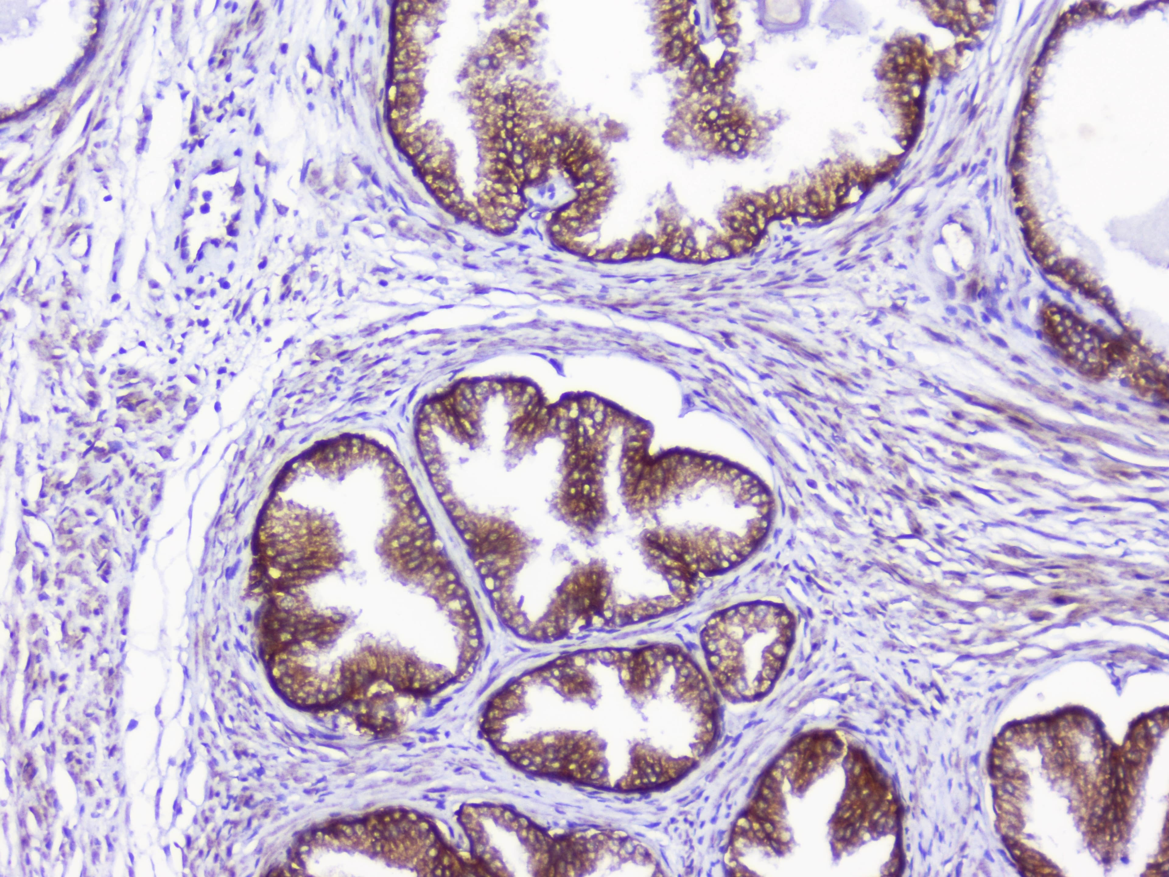 CD46 Antibody (aa366-392)