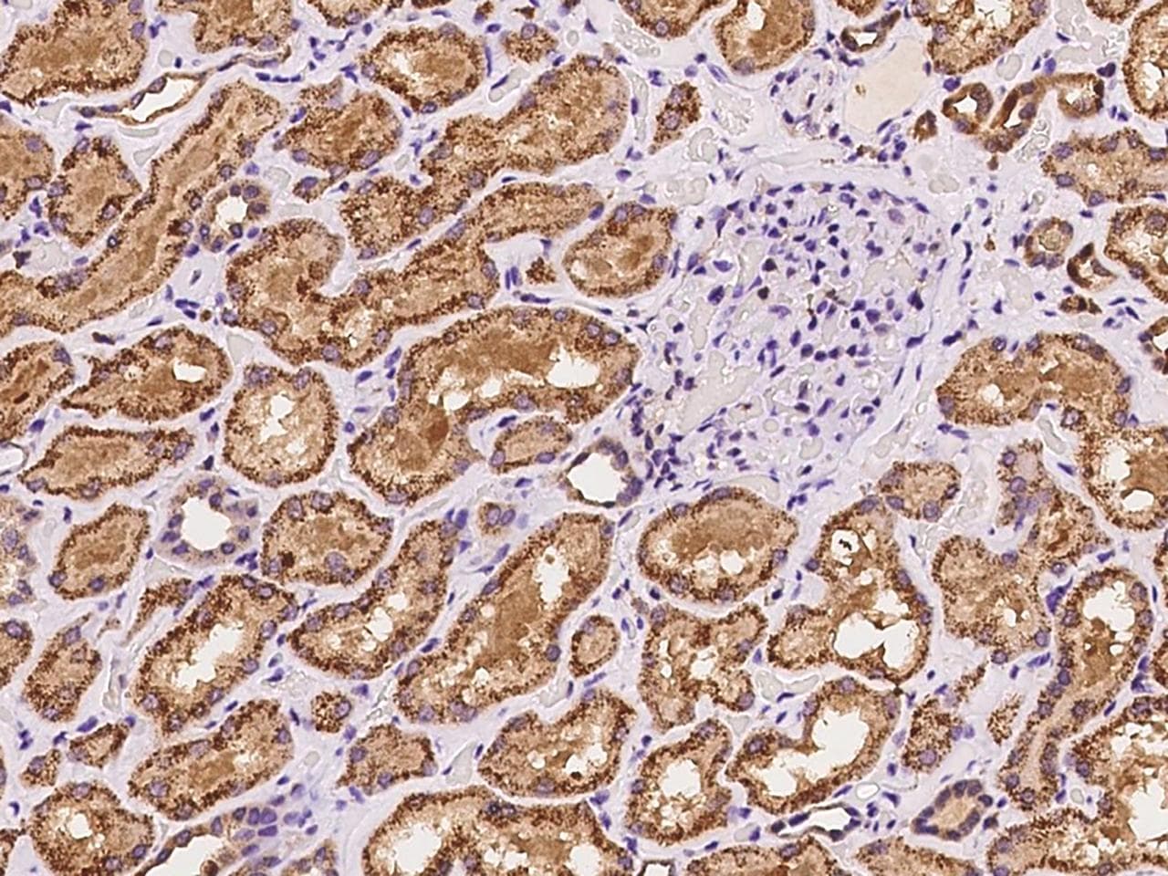 Polyclonal Rabbit anti-Human GPC4 / Glypican 4 Antibody (IHC)