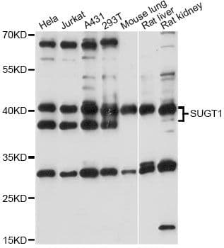 Polyclonal Rabbit anti-Human SUGT1 / SGT1 Antibody (WB)