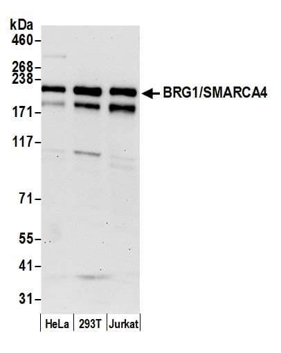 PathPlus™ SMARCA4 / BRG1 Antibody (aa75-125)