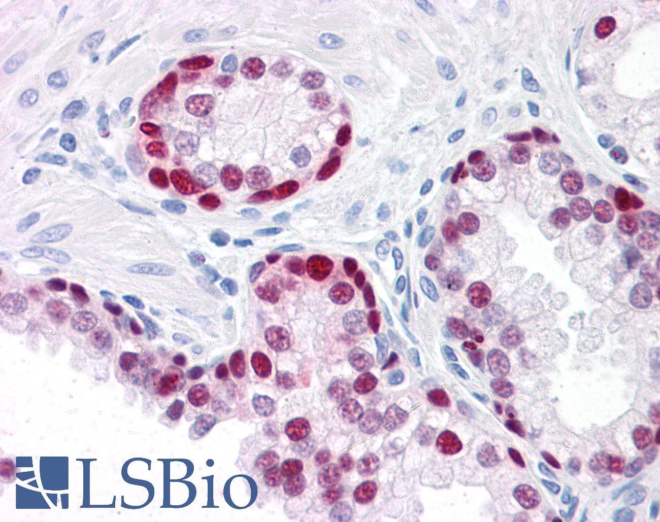 PathPlus™ Monoclonal Mouse anti-Human SOX9 Antibody (clone 3F11, IHC, IF, WB)