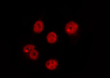 Polyclonal Rabbit anti-Human CDC25C Antibody (IHC, IF, WB)