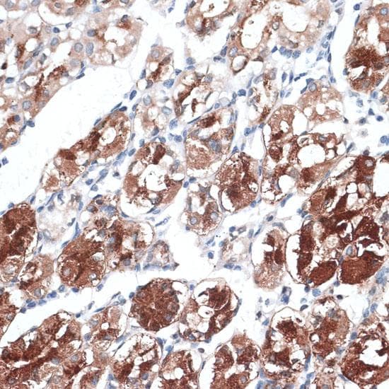 DTNBP1 / Dysbindin Antibody