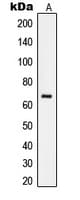 RELA / NFKB p65 Antibody (C-Terminus)