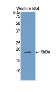 IFN Gamma / Interferon Gamma Antibody (aa24-166)