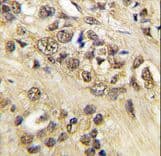 MYC / c-Myc Antibody (Thr58)